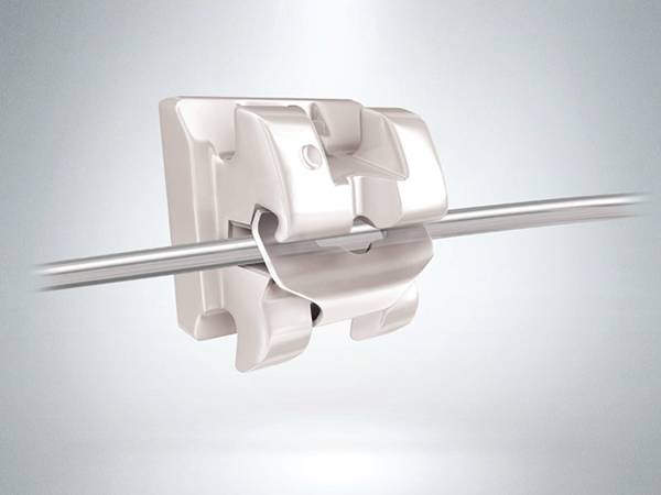 A piece of rectangular archwire on the bracket.